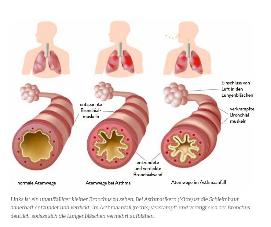 Allergien? Ohne mich!