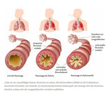 Allergien? Ohne mich!